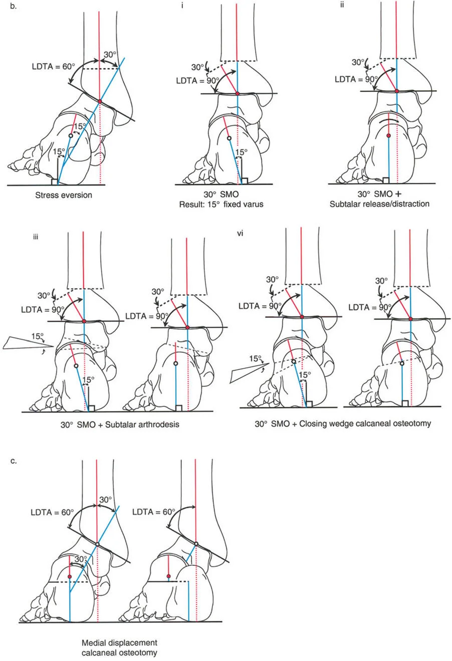 صورة طبية: الاستاذ الدكتور محمد هطيف: دليل شامل لتشوهات قصبة الساق البعيدة والكاحل في صنعاء
