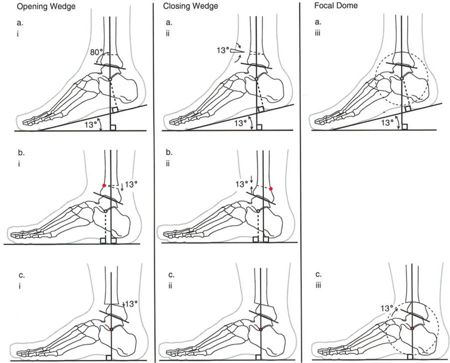 صورة طبية: الاستاذ الدكتور محمد هطيف: دليل شامل لتشوهات قصبة الساق البعيدة والكاحل في صنعاء