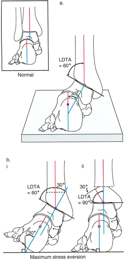 صورة طبية: الاستاذ الدكتور محمد هطيف: دليل شامل لتشوهات قصبة الساق البعيدة والكاحل في صنعاء