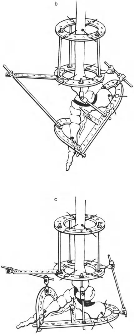 صورة طبية: الاستاذ الدكتور محمد هطيف: دليل شامل لتشوهات قصبة الساق البعيدة والكاحل في صنعاء