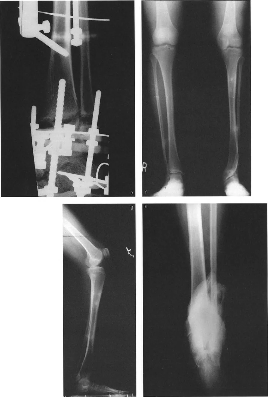 صورة طبية: الاستاذ الدكتور محمد هطيف: دليل شامل لتشوهات قصبة الساق البعيدة والكاحل في صنعاء
