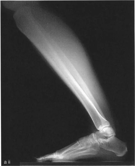 صورة طبية: الاستاذ الدكتور محمد هطيف: دليل شامل لتشوهات قصبة الساق البعيدة والكاحل في صنعاء