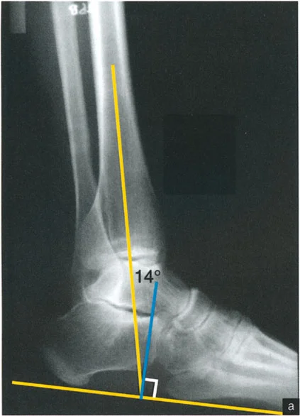 وصف طبي دقيق للمريض