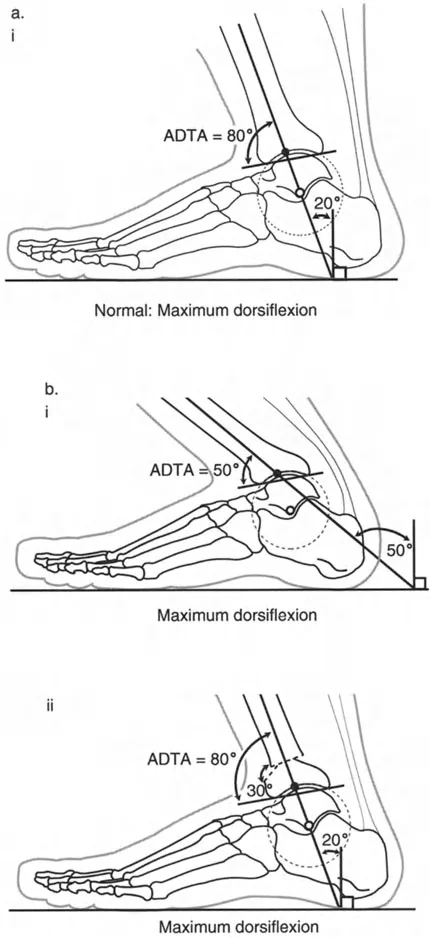 صورة توضيحية لـ الاستاذ الدكتور محمد هطيف: دليل شامل لتشوهات قصبة الساق البعيدة والكاحل في صنعاء
