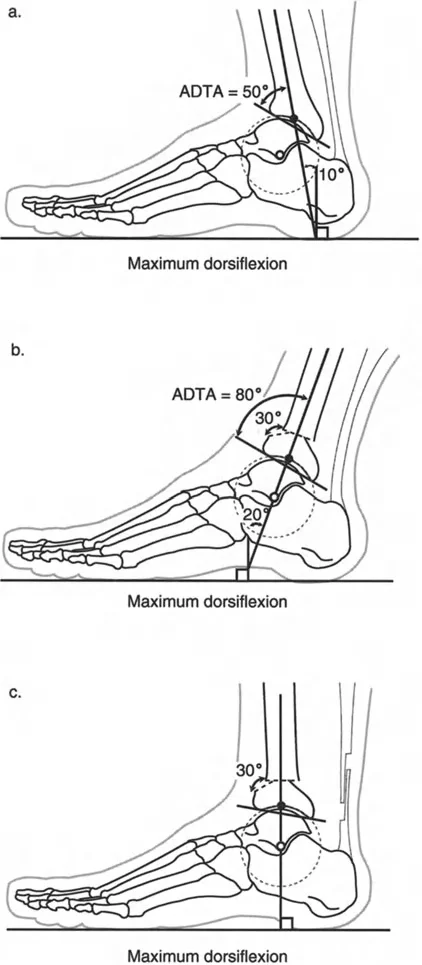 صورة طبية: الاستاذ الدكتور محمد هطيف: دليل شامل لتشوهات قصبة الساق البعيدة والكاحل في صنعاء
