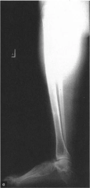 صورة طبية: الاستاذ الدكتور محمد هطيف: دليل شامل لتشوهات قصبة الساق البعيدة والكاحل في صنعاء