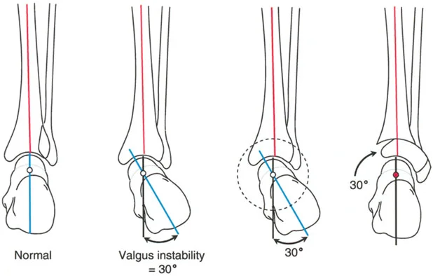 صورة طبية: الاستاذ الدكتور محمد هطيف: دليل شامل لتشوهات قصبة الساق البعيدة والكاحل في صنعاء