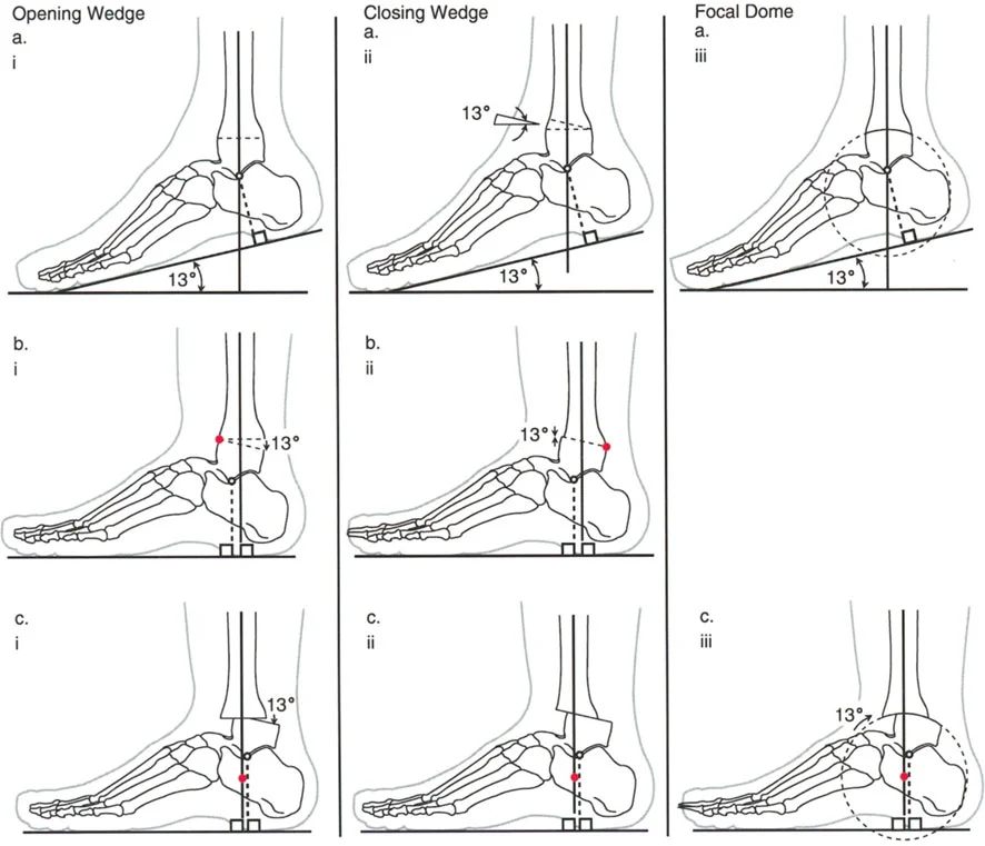 صورة طبية: الاستاذ الدكتور محمد هطيف: دليل شامل لتشوهات قصبة الساق البعيدة والكاحل في صنعاء