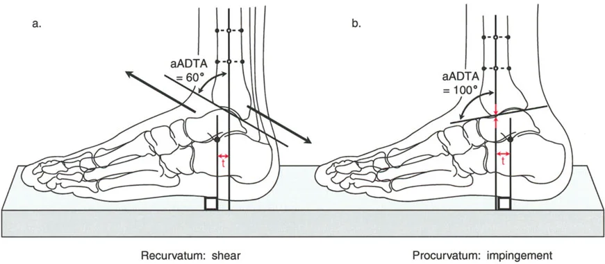 صورة توضيحية لـ الاستاذ الدكتور محمد هطيف: دليل شامل لتشوهات قصبة الساق البعيدة والكاحل في صنعاء