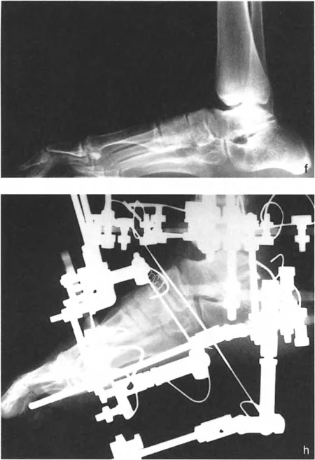 صورة طبية: الاستاذ الدكتور محمد هطيف: دليل شامل لتشوهات قصبة الساق البعيدة والكاحل في صنعاء