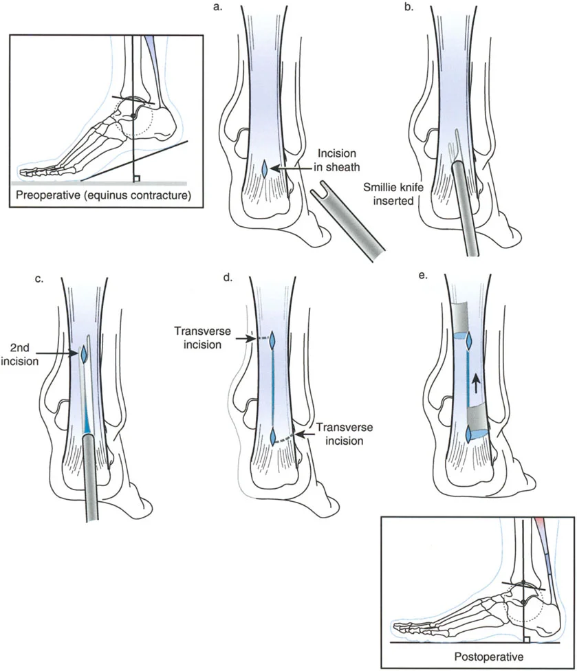 وصف طبي دقيق للمريض