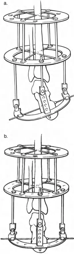 صورة طبية: تشوهات الكاحل والقدم: الأسباب، التشخيص، والعلاج المتقدم مع الأستاذ الدكتور محمد هطيف في صنعاء