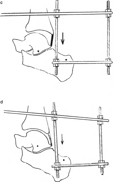 صورة توضيحية لـ تشوهات الكاحل والقدم: الأسباب، التشخيص، والعلاج المتقدم مع الأستاذ الدكتور محمد هطيف في صنعاء