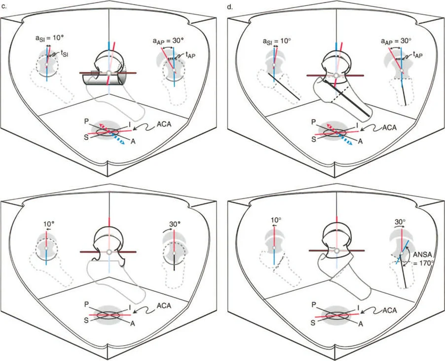 صورة توضيحية لتطبيق قواعد بالي
![صورة طبية: دليلك الشامل لتصحيح تشوهات مفصل الورك: من التشخيص إلى التعافي مع الأستاذ الدكتور محمد هطيف في صنعاء