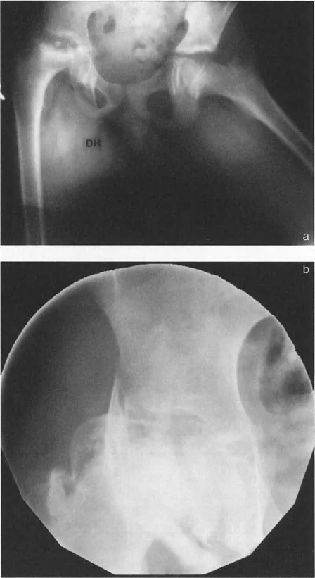 صورة توضيحية لـ دليلك الشامل لتصحيح تشوهات مفصل الورك: من التشخيص إلى التعافي مع الأستاذ الدكتور محمد هطيف في صنعاء