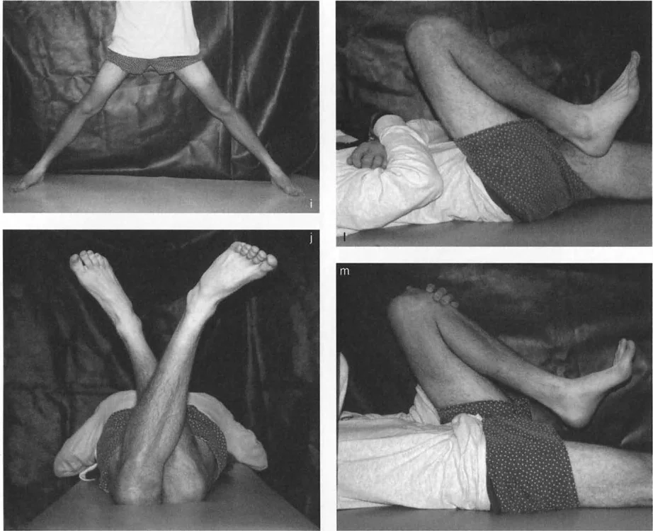 صورة طبية: دليلك الشامل لتصحيح تشوهات مفصل الورك: من التشخيص إلى التعافي مع الأستاذ الدكتور محمد هطيف في صنعاء