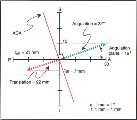صورة طبية: دليلك الشامل لتصحيح تشوهات مفصل الورك: من التشخيص إلى التعافي مع الأستاذ الدكتور محمد هطيف في صنعاء