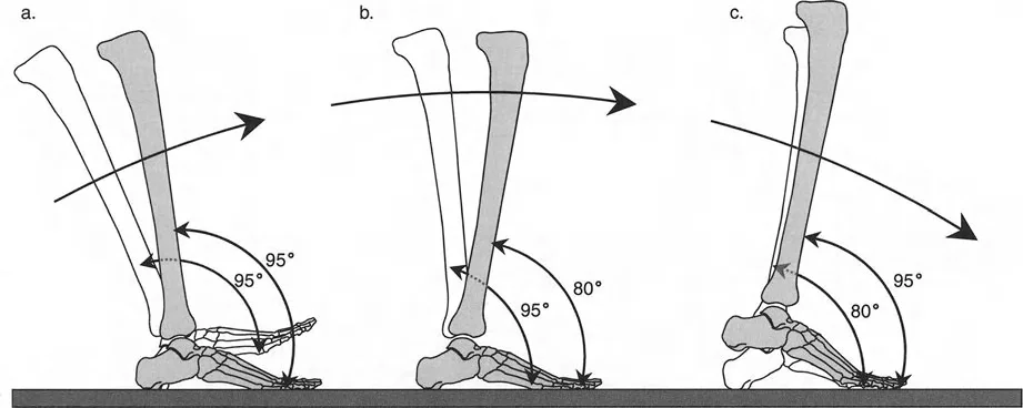 صورة طبية: إتقان ميكانيكا المشي الحيوية وتصحيح تشوهات الأطراف السفلية: نهج الأستاذ الدكتور محمد هطيف في صنعاء