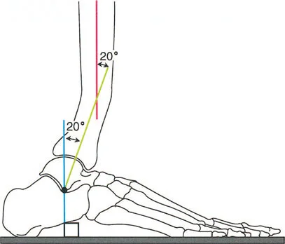 صورة طبية: إتقان ميكانيكا المشي الحيوية وتصحيح تشوهات الأطراف السفلية: نهج الأستاذ الدكتور محمد هطيف في صنعاء