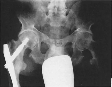 صورة توضيحية لـ إتقان ميكانيكا المشي الحيوية وتصحيح تشوهات الأطراف السفلية: نهج الأستاذ الدكتور محمد هطيف في صنعاء