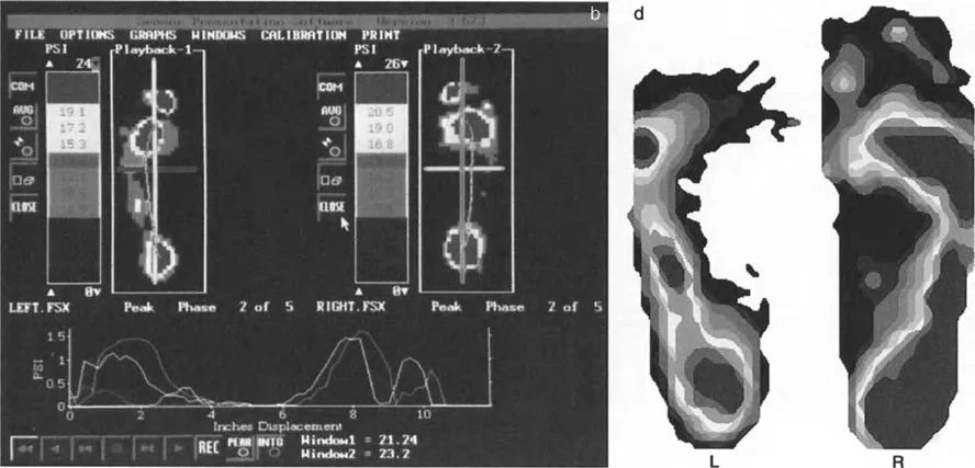 صورة طبية: إتقان ميكانيكا المشي الحيوية وتصحيح تشوهات الأطراف السفلية: نهج الأستاذ الدكتور محمد هطيف في صنعاء