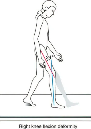 رسم توضيحي لمتجه رد فعل الأرض الطبيعي