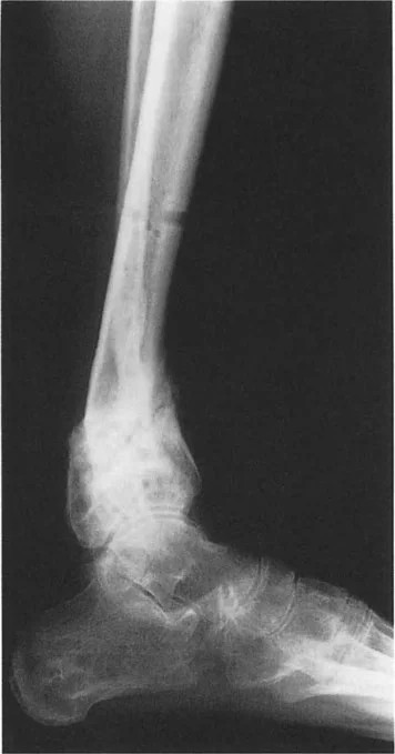 رسم توضيحي لميكانيكا القدم