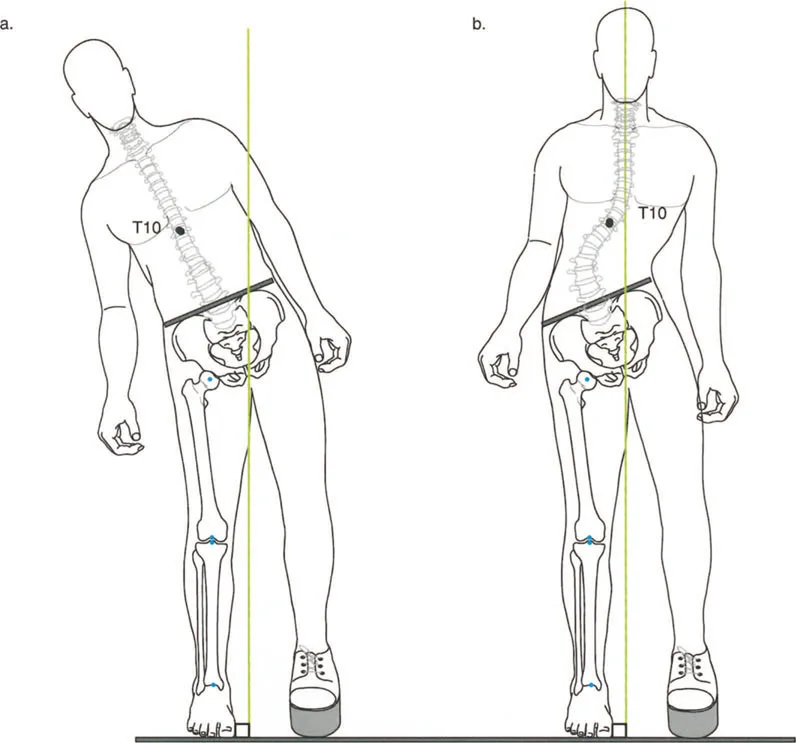 صورة طبية: إتقان ميكانيكا المشي الحيوية وتصحيح تشوهات الأطراف السفلية: نهج الأستاذ الدكتور محمد هطيف في صنعاء