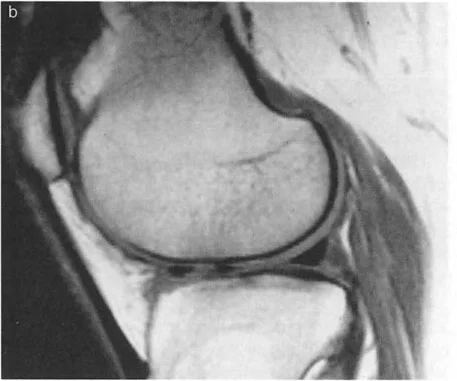 صورة طبية: إتقان ميكانيكا المشي الحيوية وتصحيح تشوهات الأطراف السفلية: نهج الأستاذ الدكتور محمد هطيف في صنعاء