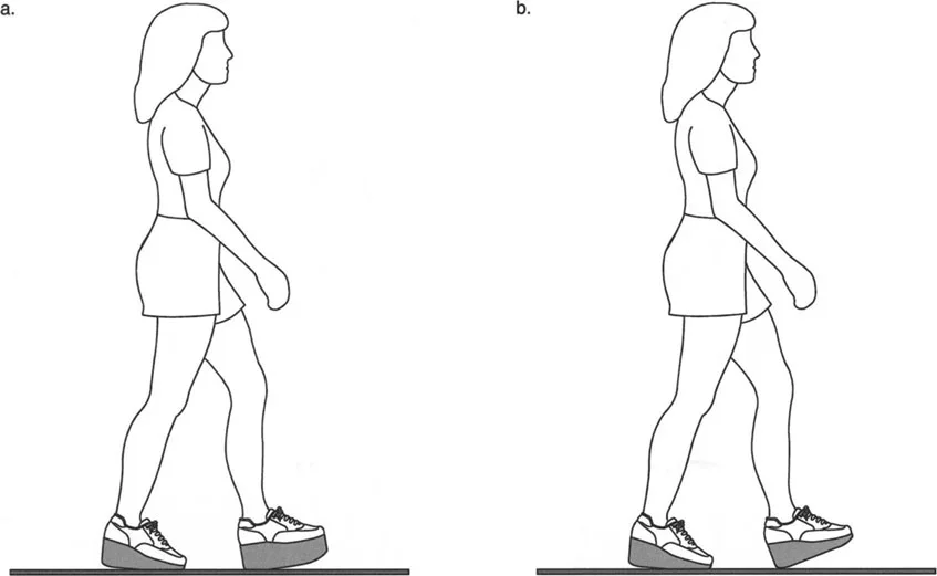 صورة طبية: إتقان ميكانيكا المشي الحيوية وتصحيح تشوهات الأطراف السفلية: نهج الأستاذ الدكتور محمد هطيف في صنعاء