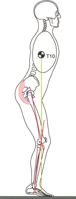 صورة توضيحية لـ إتقان ميكانيكا المشي العظمية: دليل شامل لتصحيح التشوهات الديناميكية مع الأستاذ الدكتور محمد هطيف