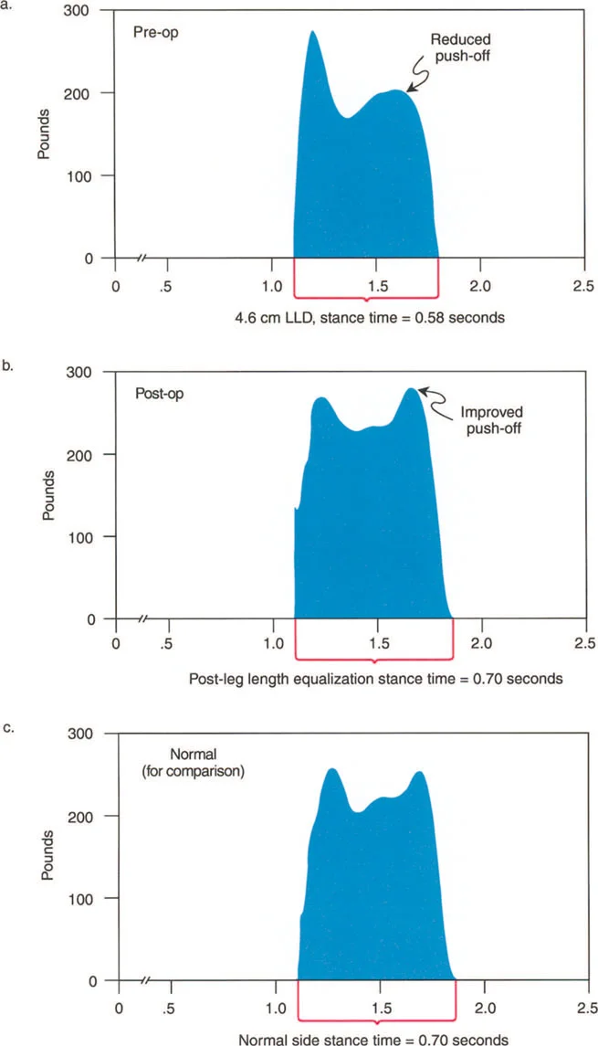 صورة طبية: إتقان ميكانيكا المشي العظمية: دليل شامل لتصحيح التشوهات الديناميكية مع الأستاذ الدكتور محمد هطيف
