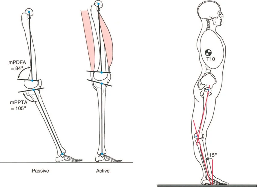 صورة توضيحية لـ إتقان ميكانيكا المشي العظمية: دليل شامل لتصحيح التشوهات الديناميكية مع الأستاذ الدكتور محمد هطيف