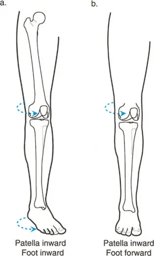 صورة طبية: إتقان ميكانيكا المشي العظمية: دليل شامل لتصحيح التشوهات الديناميكية مع الأستاذ الدكتور محمد هطيف