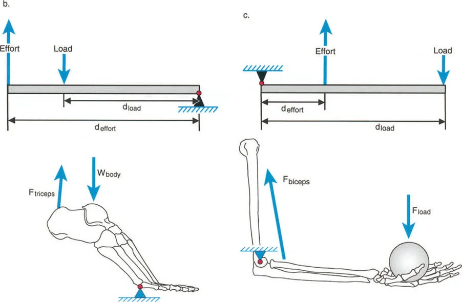 صورة طبية: فهم وعلاج التشوهات الديناميكية وخلل ميكانيكا الأذرع الرافعة في جراحة العظام مع الأستاذ الدكتور محمد هطيف