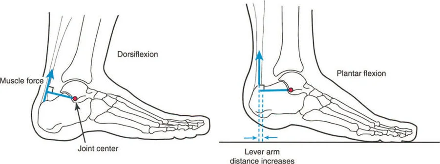 صورة طبية: فهم وعلاج التشوهات الديناميكية وخلل ميكانيكا الأذرع الرافعة في جراحة العظام مع الأستاذ الدكتور محمد هطيف