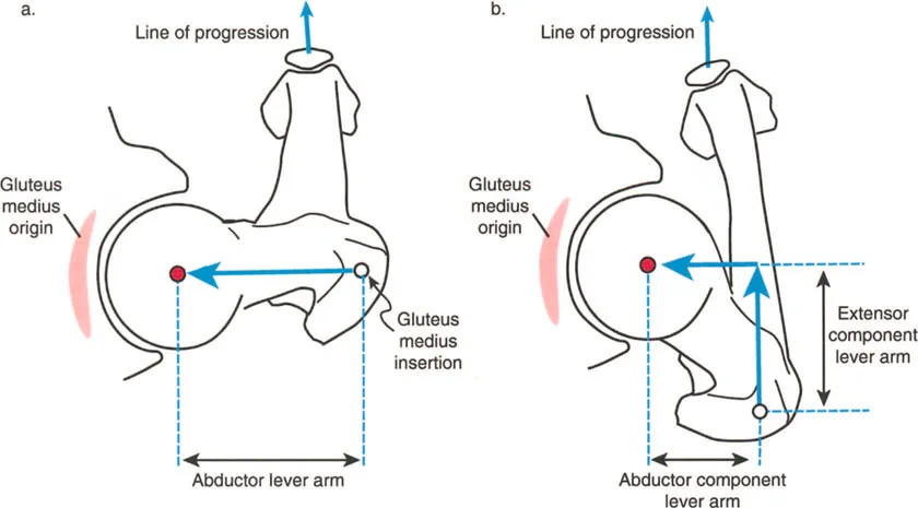 صورة طبية: فهم وعلاج التشوهات الديناميكية وخلل ميكانيكا الأذرع الرافعة في جراحة العظام مع الأستاذ الدكتور محمد هطيف