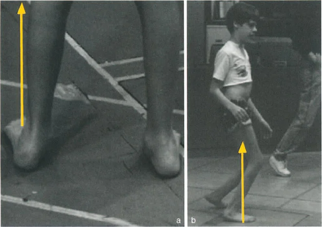 صورة طبية: فهم وعلاج التشوهات الديناميكية وخلل ميكانيكا الأذرع الرافعة في جراحة العظام مع الأستاذ الدكتور محمد هطيف