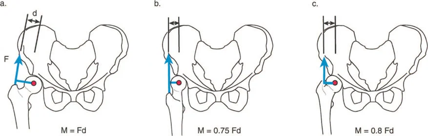 صورة طبية: فهم وعلاج التشوهات الديناميكية وخلل ميكانيكا الأذرع الرافعة في جراحة العظام مع الأستاذ الدكتور محمد هطيف