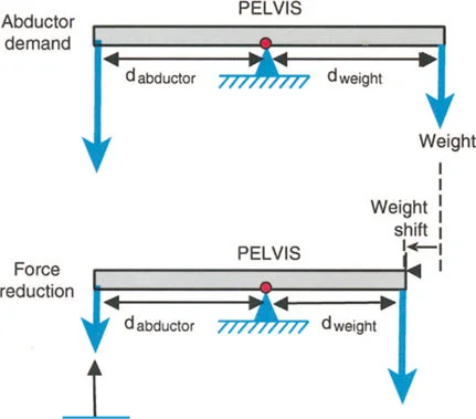 صورة توضيحية لـ فهم وعلاج التشوهات الديناميكية وخلل ميكانيكا الأذرع الرافعة في جراحة العظام مع الأستاذ الدكتور محمد هطيف