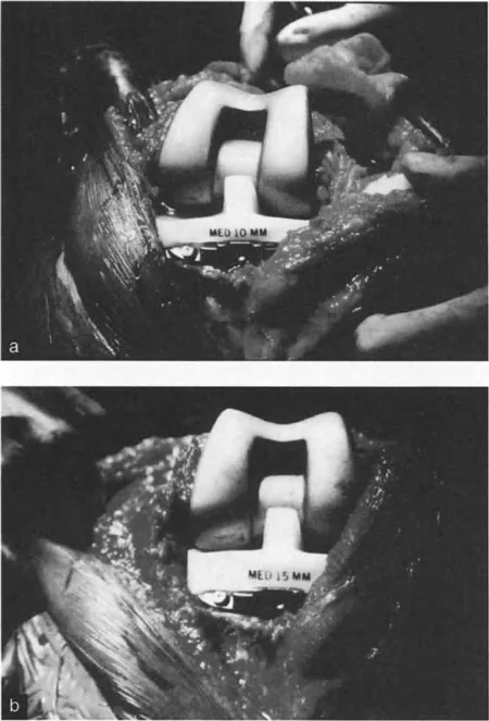 صورة طبية: فهم وعلاج التشوهات الديناميكية وخلل ميكانيكا الأذرع الرافعة في جراحة العظام مع الأستاذ الدكتور محمد هطيف