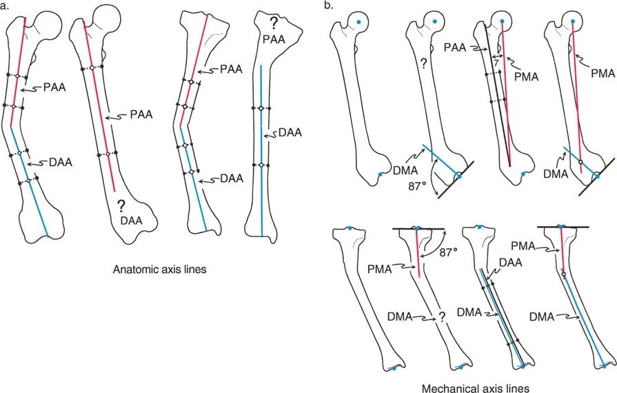 تصحيح تشوهات الأطراف السفلية الكلي: دليل شامل للتخطيط الدقيق والعلاج المتقدم في صنعاء مع الأستاذ الدكتور محمد هطيف