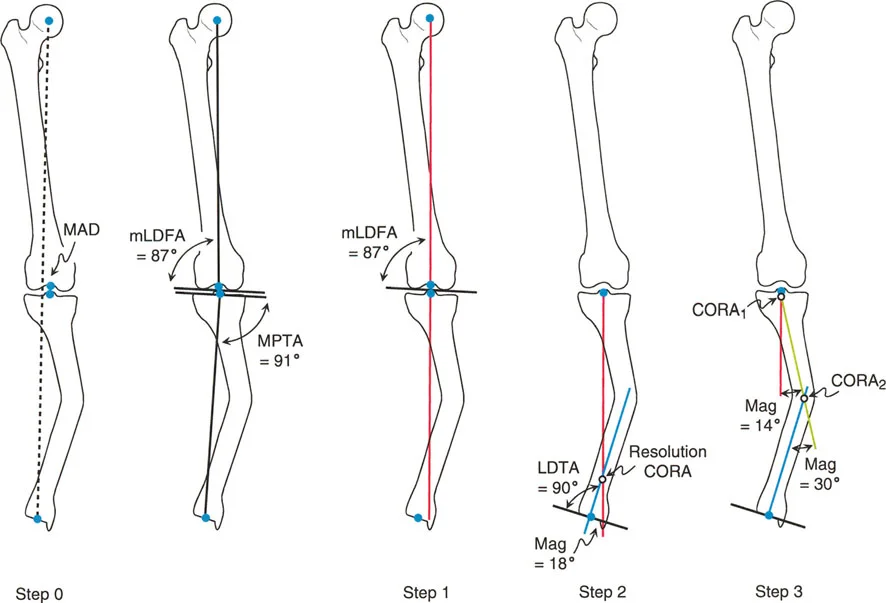 صورة طبية: تصحيح انحرافات الساقين والأطراف السفلية في صنعاء: دليل شامل مع الأستاذ الدكتور محمد هطيف
