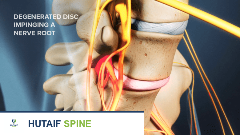 الألم المزمن والاكتئاب دليل شامل للتعامل والعلاج مع الأستاذ الدكتور محمد هطيف