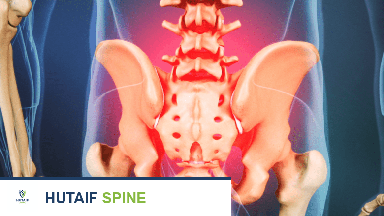 صورة توضيحية لحوض بالغ مع تسليط الضوء باللون الأحمر على منطقة الشريان الأورطي