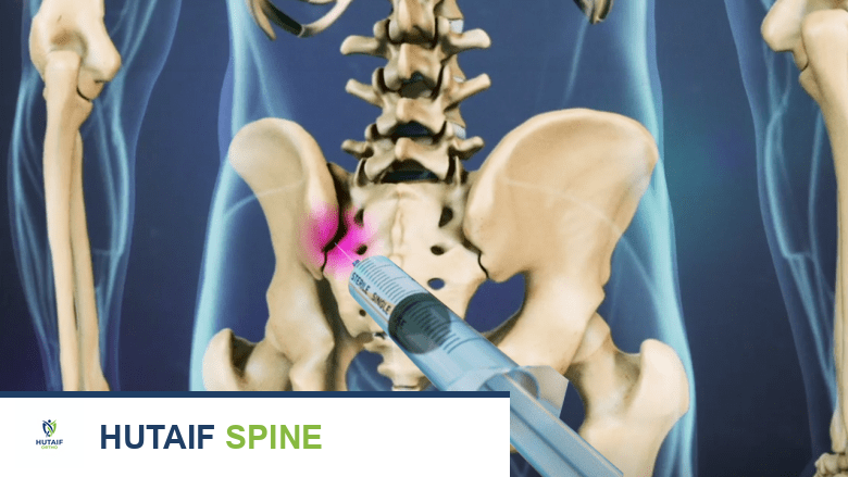 التشخيص الدقيق لاختلال المفصل العجزي الحرقفي: دليل شامل للمرضى في صنعاء مع الأستاذ الدكتور محمد هطيف