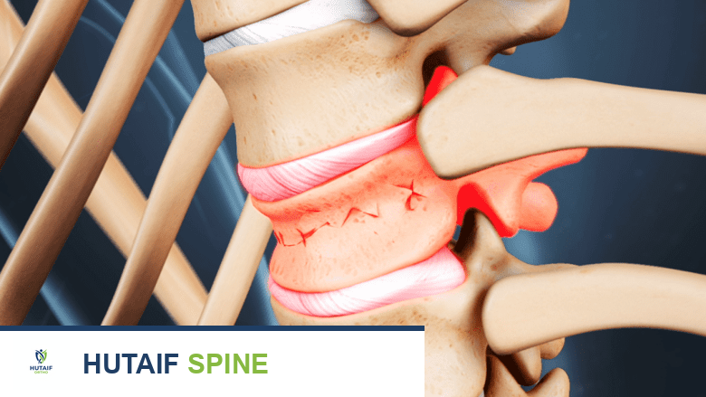 طريقة الأكتيفيتور: فعالية، أمان، ومخاطر العلاج اللطيف للعمود الفقري والأطراف مع الأستاذ الدكتور محمد هطيف في صنعاء