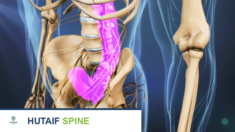 الإمساك بعد جراحة ACDF: دليلك الشامل للوقاية والعلاج والتعافي