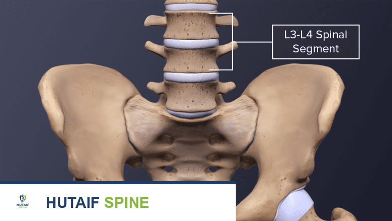عرض ثلاثي الأبعاد لعظم الورك والعمود الفقري القطني.
