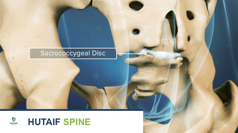 توضيح للقرص العجزي العصعصي باللون الأبيض.